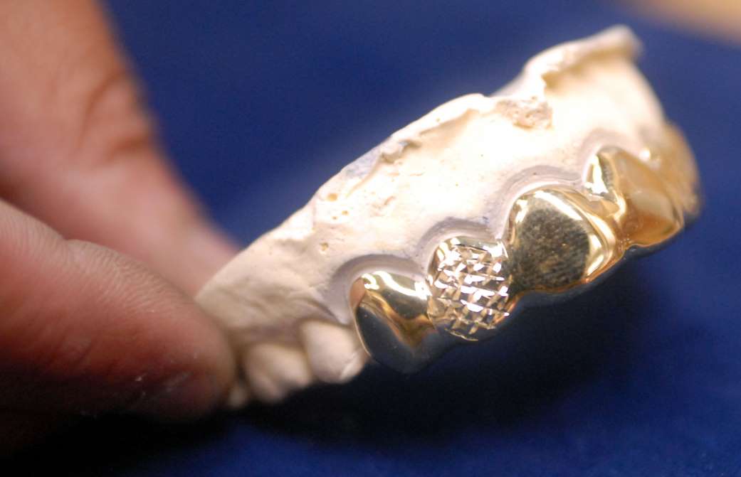 golddent