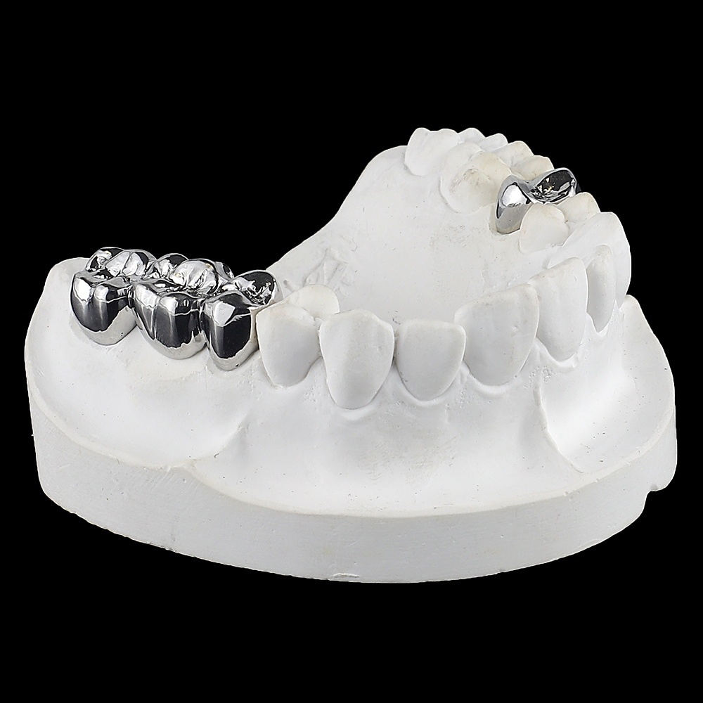 FM Crown Full Cast Crown Dental Supply Dental Crown Equipment Denture Orthodontic Dental Implant Products From China Dental Lab