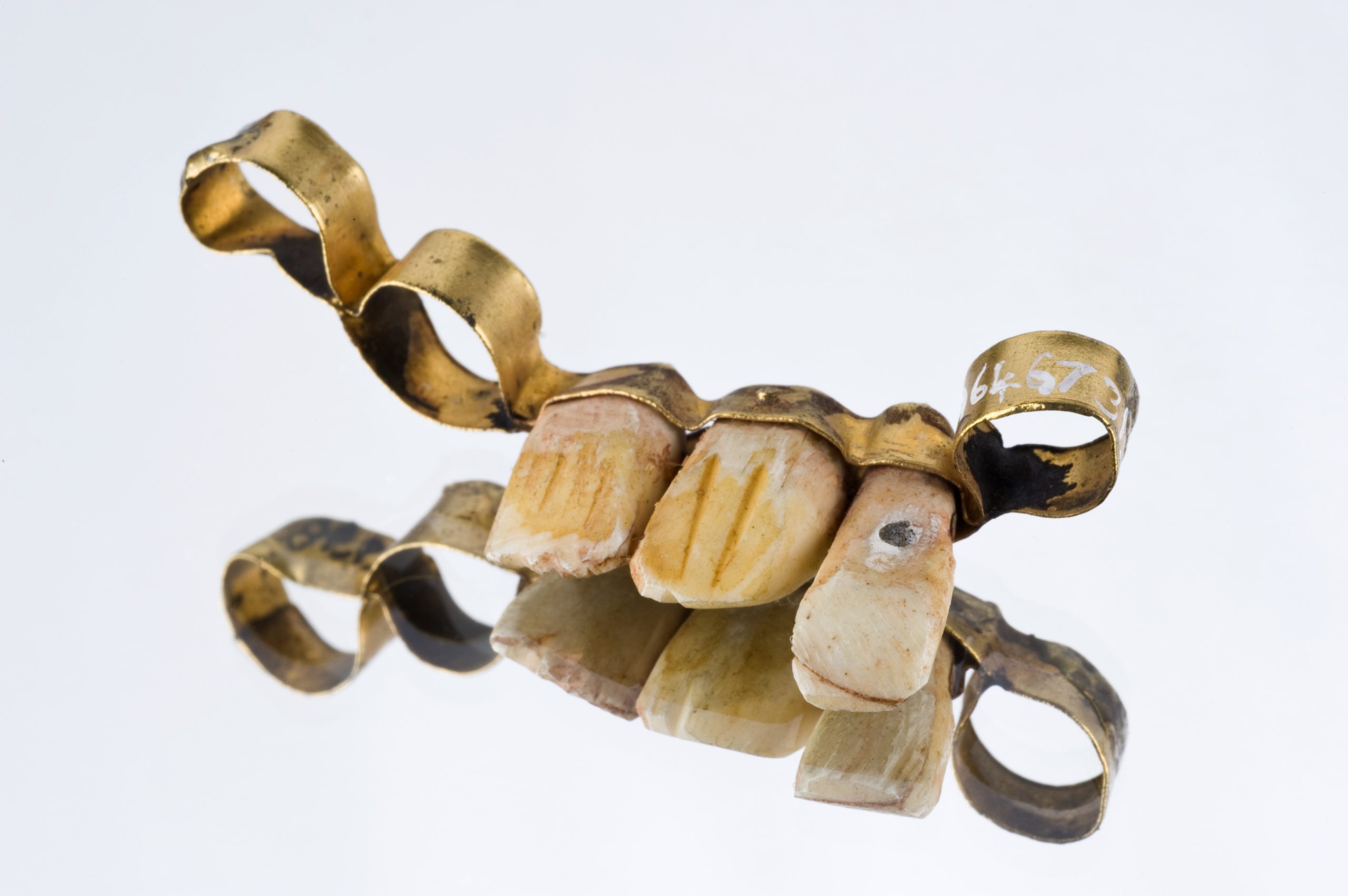 or dentaire de lepoque romaine scaled 1